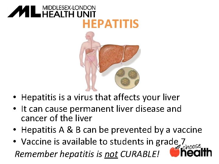 HEPATITIS • Hepatitis is a virus that affects your liver • It can cause