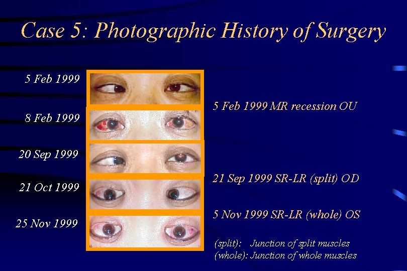 Case 5: Photographic History of Surgery 5 Feb 1999 8 Feb 1999 5 Feb