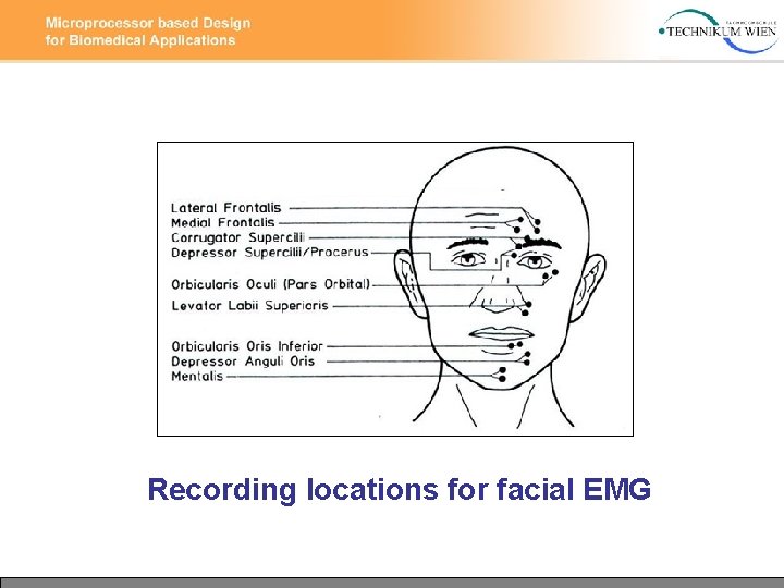 Recording locations for facial EMG 