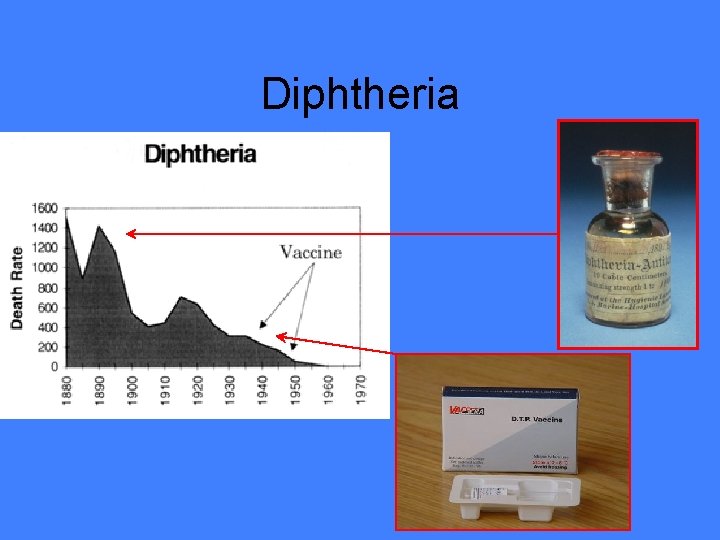 Diphtheria 