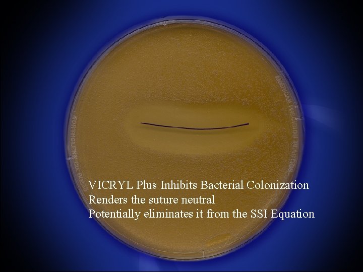 VICRYL Plus Inhibits Bacterial Colonization Renders the suture neutral Potentially eliminates it from the