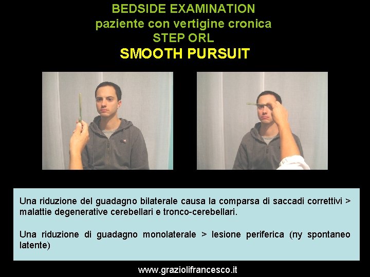 BEDSIDE EXAMINATION paziente con vertigine cronica STEP ORL SMOOTH PURSUIT Una riduzione del guadagno