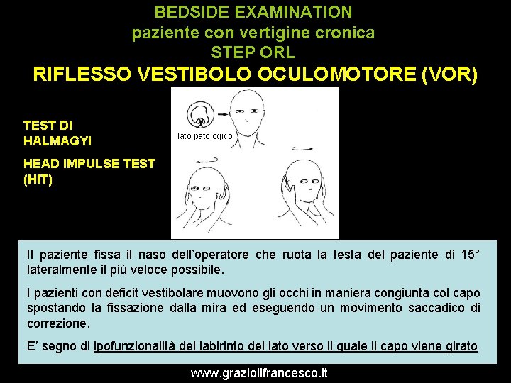 BEDSIDE EXAMINATION paziente con vertigine cronica STEP ORL RIFLESSO VESTIBOLO OCULOMOTORE (VOR) TEST DI
