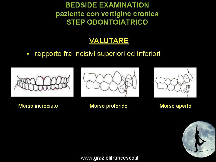 BEDSIDE EXAMINATION paziente con vertigine cronica STEP ODONTOIATRICO VALUTARE • rapporto fra incisivi superiori