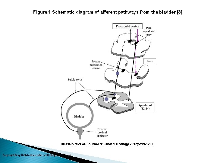 Figure 1 Schematic diagram of afferent pathways from the bladder [3]. Hussain M et