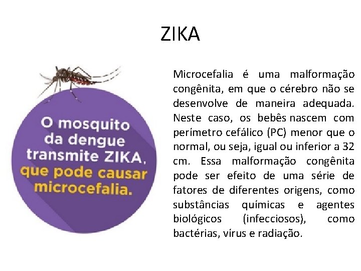 ZIKA Microcefalia é uma malformação congênita, em que o cérebro não se desenvolve de