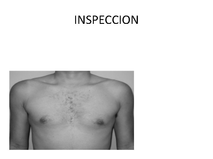 INSPECCION 