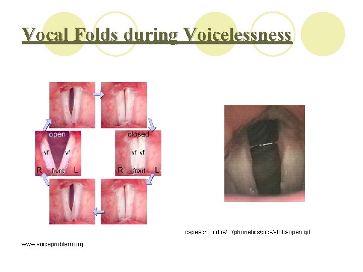 Vocal Folds during Voicelessness cspeech. ucd. ie/. . . /phonetics/pics/vfold-open. gif www. voiceproblem. org