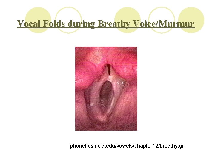 Vocal Folds during Breathy Voice/Murmur phonetics. ucla. edu/vowels/chapter 12/breathy. gif 