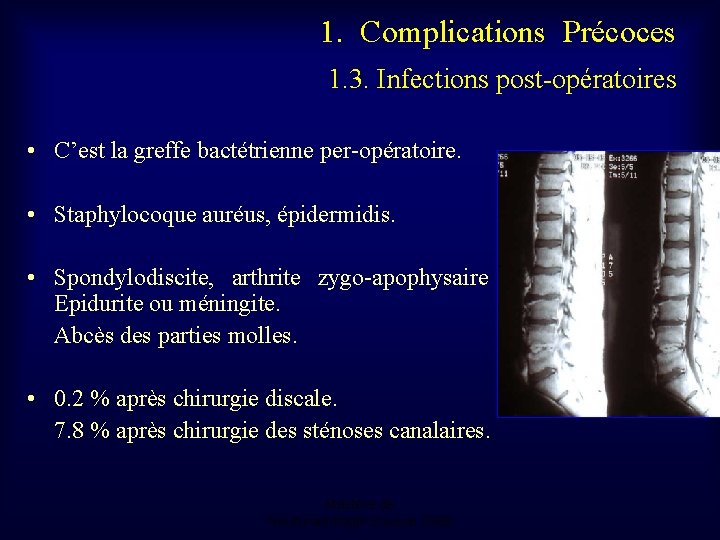 1. Complications Précoces 1. 3. Infections post-opératoires • C’est la greffe bactétrienne per-opératoire. •