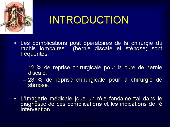 INTRODUCTION • Les complications post opératoires de la chirurgie du rachis lombaires (hernie discale