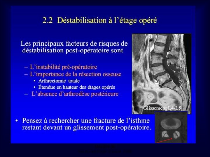 Mastère de Neuroradiologie. Sousse 2008 