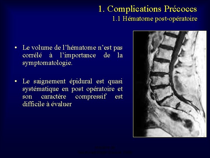 1. Complications Précoces 1. 1 Hématome post-opératoire • Le volume de l’hématome n’est pas