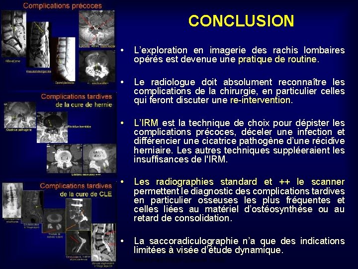 CONCLUSION • L’exploration en imagerie des rachis lombaires opérés est devenue une pratique de