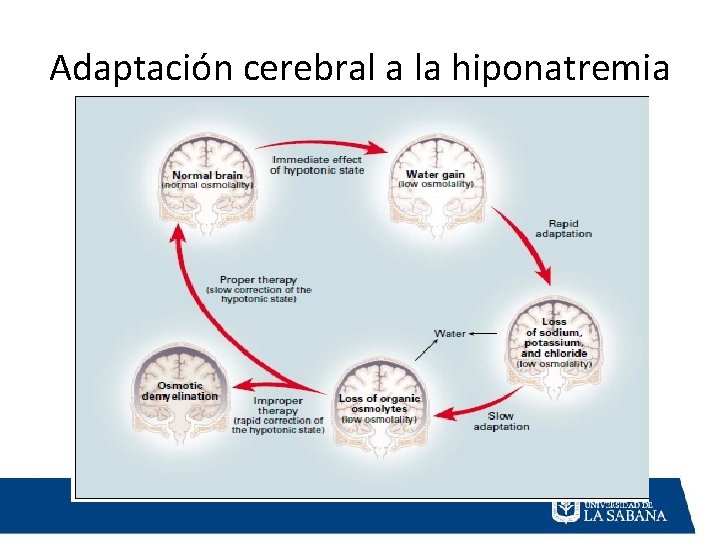 Adaptación cerebral a la hiponatremia 