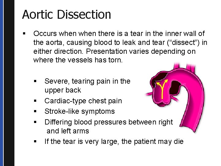 Aortic Dissection § Occurs when there is a tear in the inner wall of