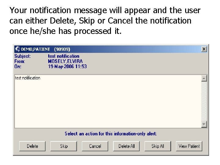 Your notification message will appear and the user can either Delete, Skip or Cancel