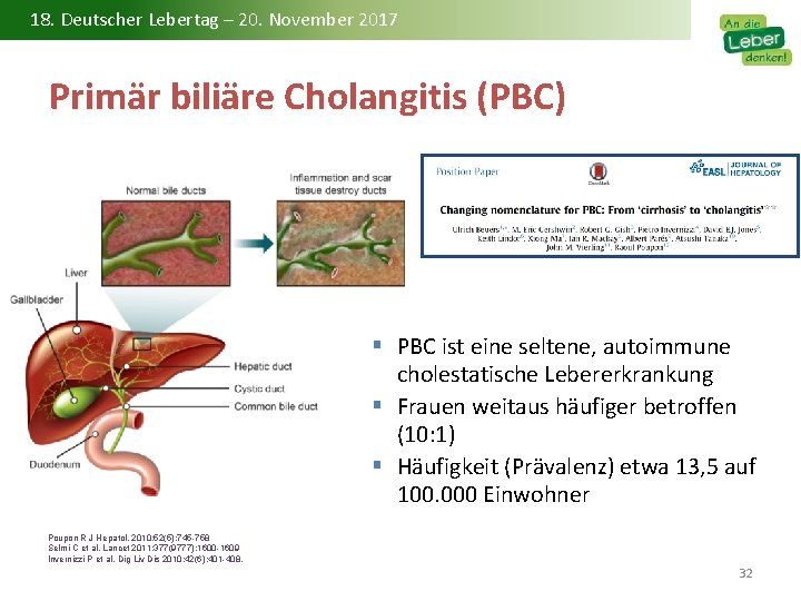 18. Deutscher Lebertag – 20. November 2017 Primär biliäre Cholangitis (PBC) § PBC ist