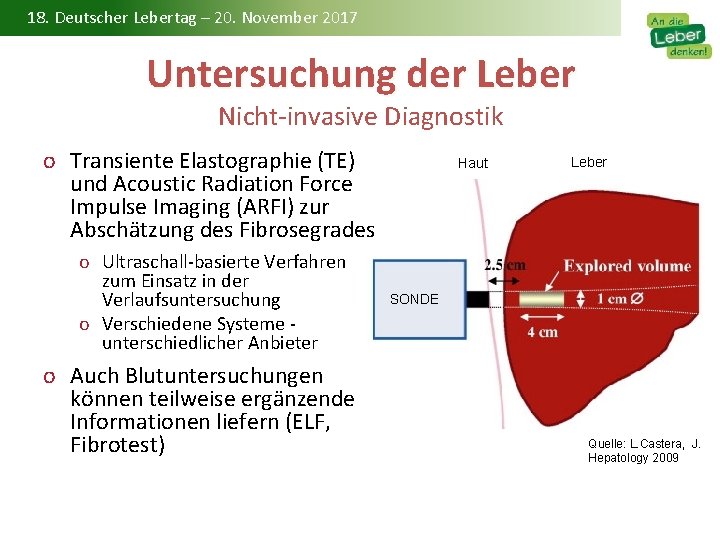 18. Deutscher Lebertag – 20. November 2017 Untersuchung der Leber Nicht-invasive Diagnostik o Transiente