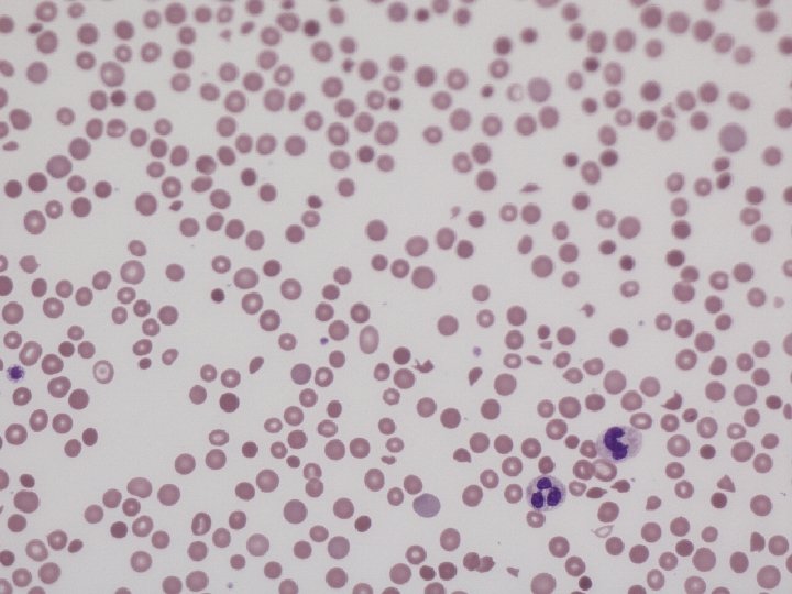 Photo blood film 