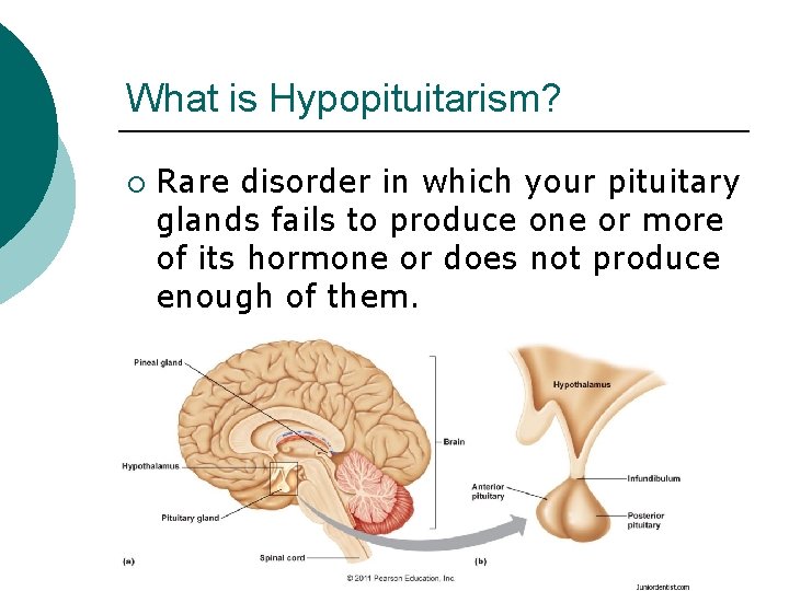 What is Hypopituitarism? ¡ Rare disorder in which your pituitary glands fails to produce