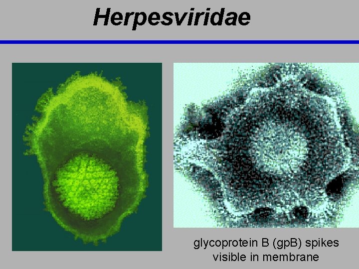 Herpesviridae glycoprotein B (gp. B) spikes visible in membrane 