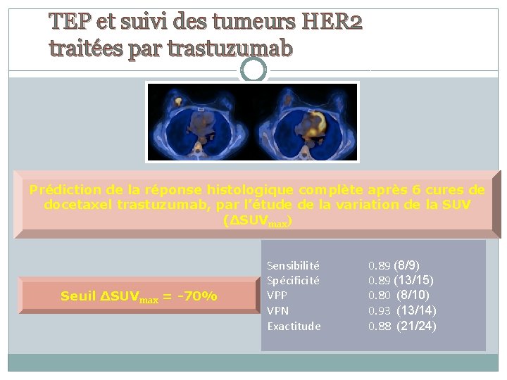 TEP et suivi des tumeurs HER 2 traitées par trastuzumab Prédiction de la réponse