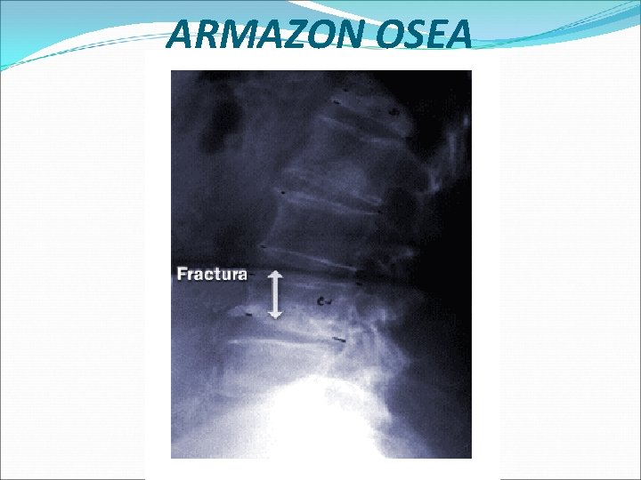 ARMAZON OSEA 