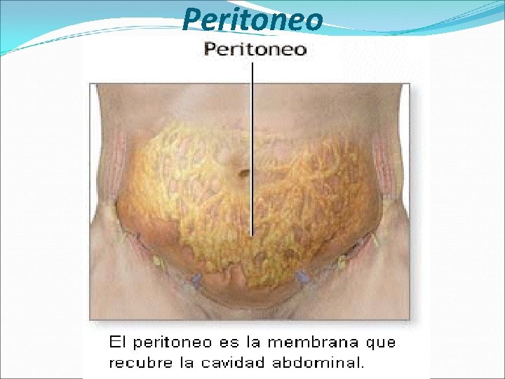 Peritoneo 