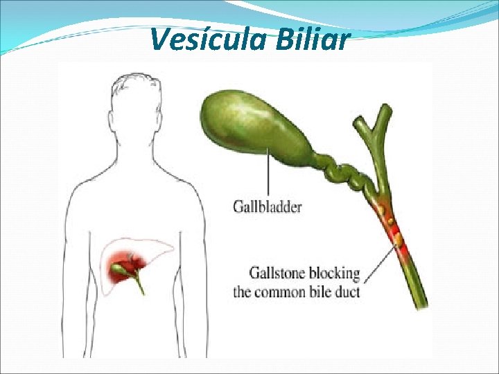 Vesícula Biliar 
