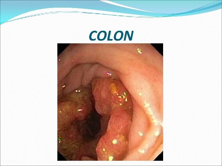 COLON 