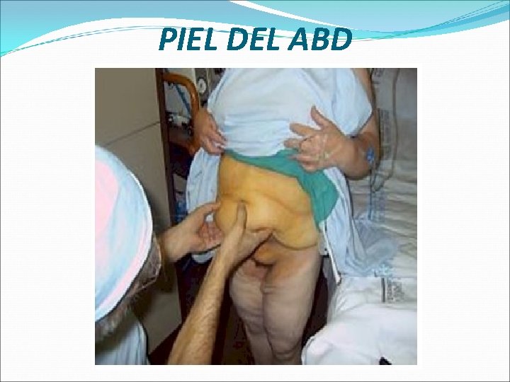 PIEL DEL ABD 