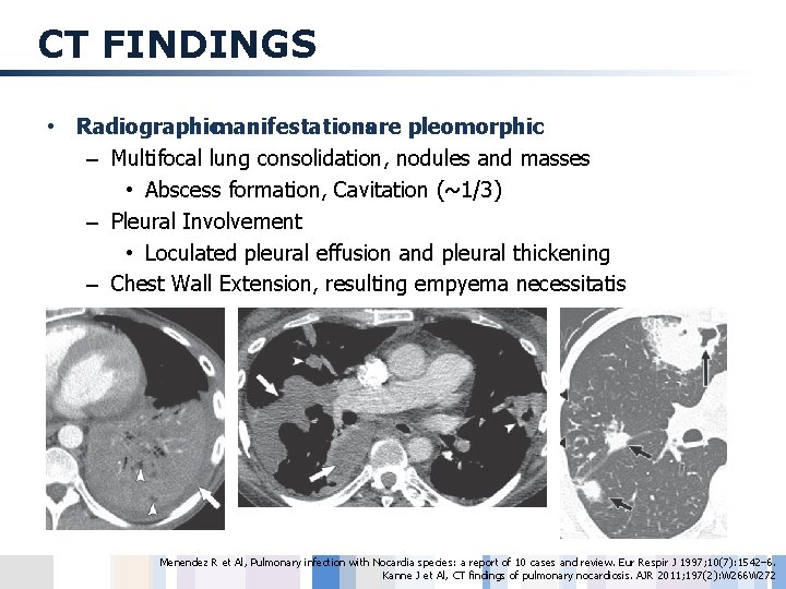 CT FINDINGS • Radiographicmanifestationsare pleomorphic – Multifocal lung consolidation, nodules and masses • Abscess