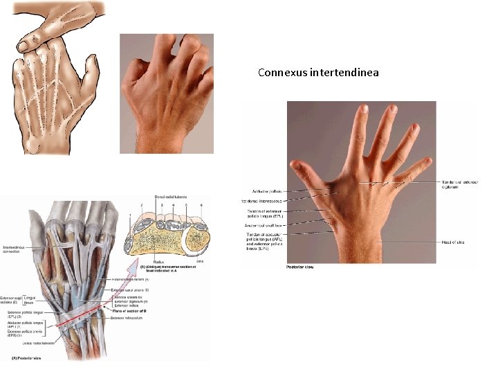 Connexus intertendinea 