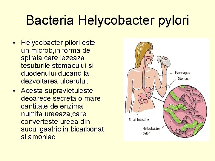 Bacteria Helycobacter pylori • Helycobacter pilori este un microb, in forma de spirala, care