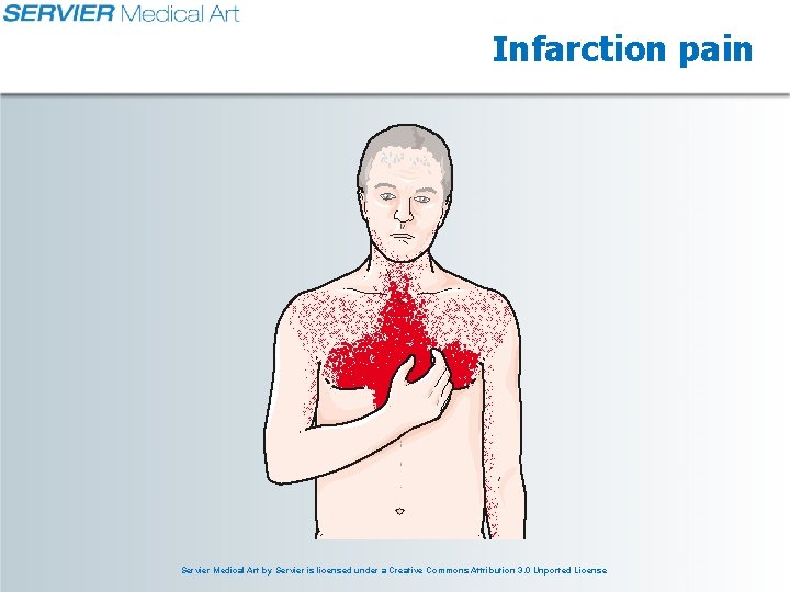 Infarction pain Servier Medical Art by Servier is licensed under a Creative Commons Attribution Infarction pain Servier Medical Art by Servier is licensed under a Creative Commons Attribution