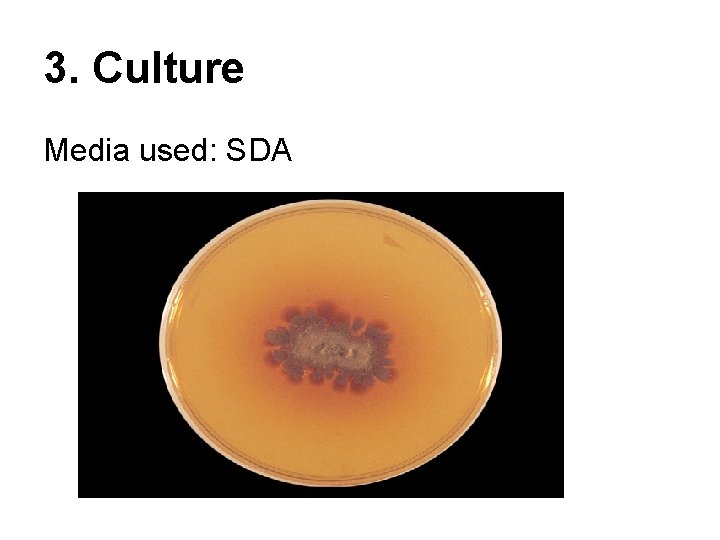 3. Culture Media used: SDA 