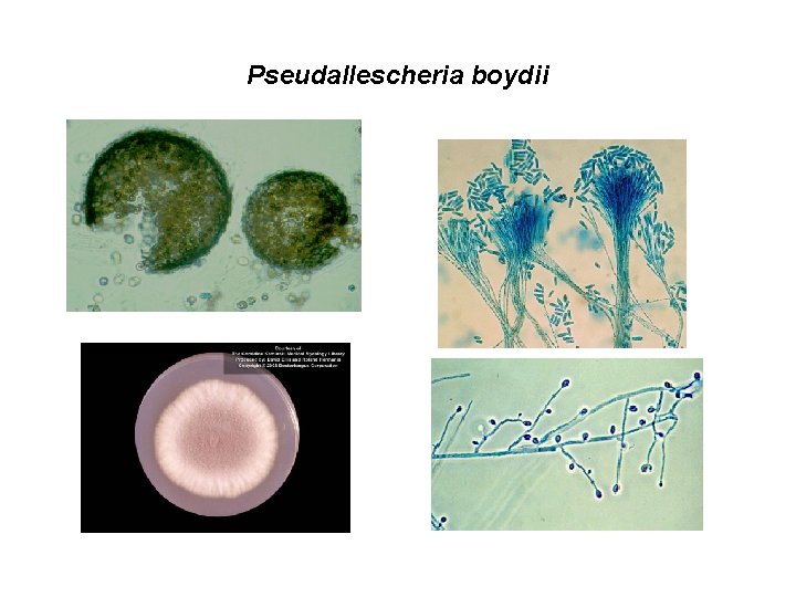 Pseudallescheria boydii 