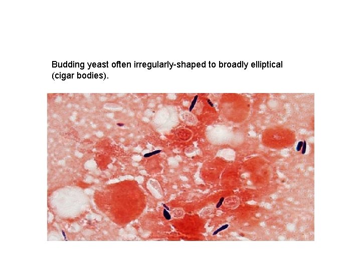 Budding yeast often irregularly-shaped to broadly elliptical (cigar bodies). 