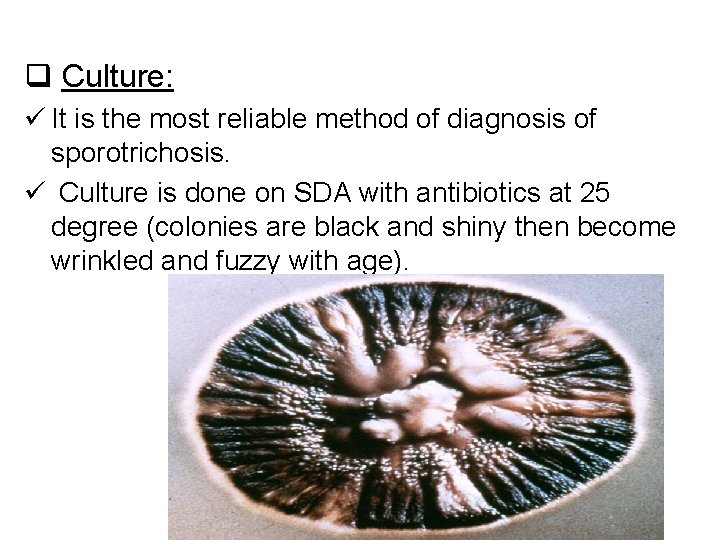 q Culture: ü It is the most reliable method of diagnosis of sporotrichosis. ü