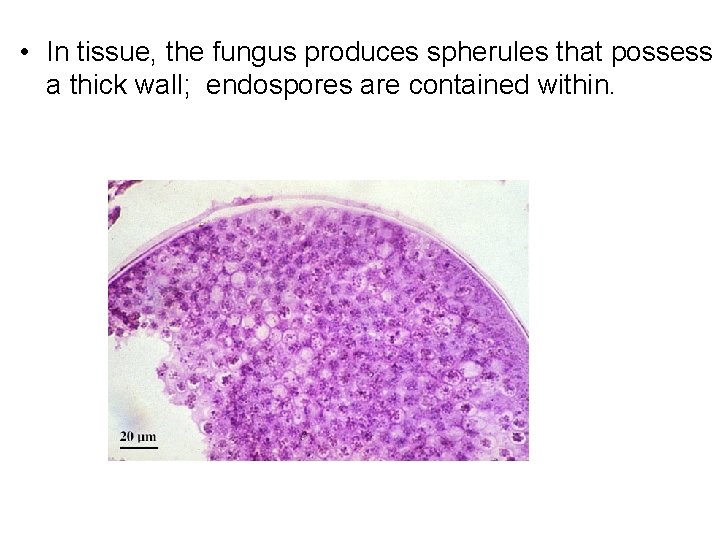  • In tissue, the fungus produces spherules that possess a thick wall; endospores