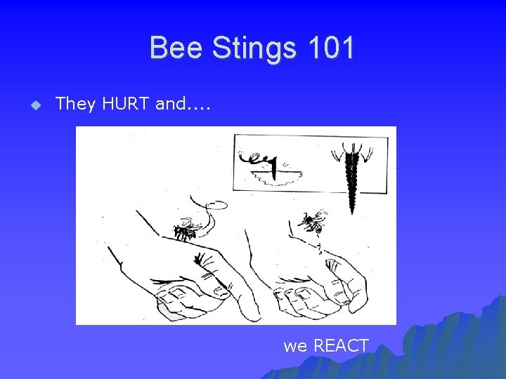 Bee Stings 101 u They HURT and. . we REACT 