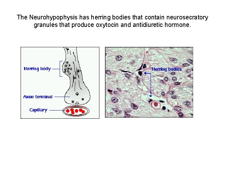The Neurohypophysis has herring bodies that contain neurosecratory granules that produce oxytocin and antidiuretic