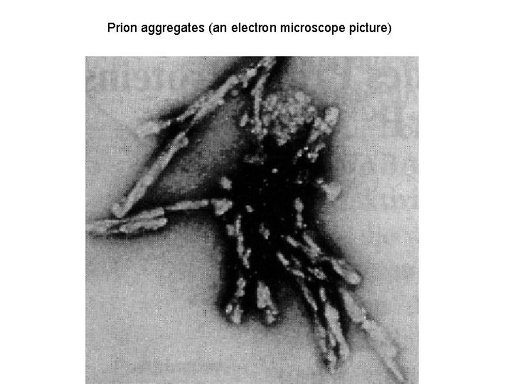 Prion aggregates (an electron microscope picture) 