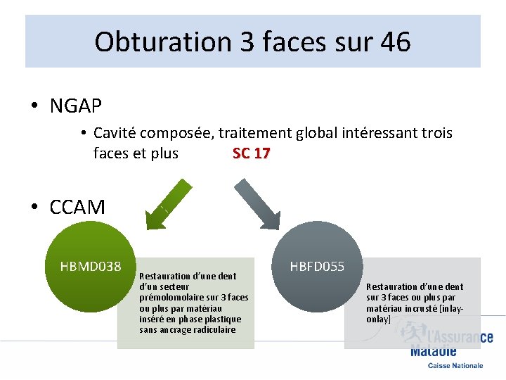Obturation 3 faces sur 46 • NGAP • Cavité composée, traitement global intéressant trois