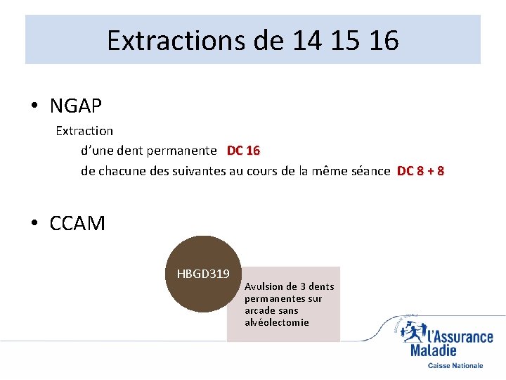 Extractions de 14 15 16 • NGAP Extraction d’une dent permanente DC 16 de