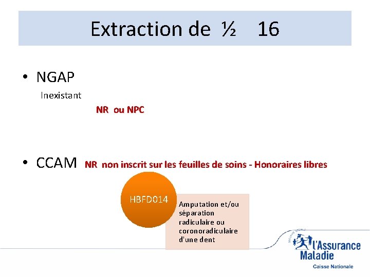 Extraction de ½ 16 • NGAP Inexistant NR ou NPC • CCAM NR non