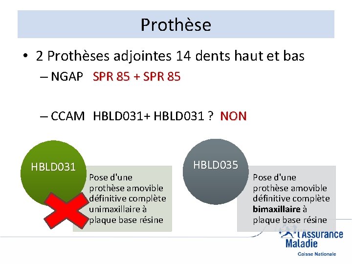 Prothèse • 2 Prothèses adjointes 14 dents haut et bas – NGAP SPR 85