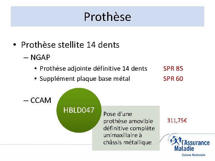 Prothèse • Prothèse stellite 14 dents – NGAP • Prothèse adjointe définitive 14 dents