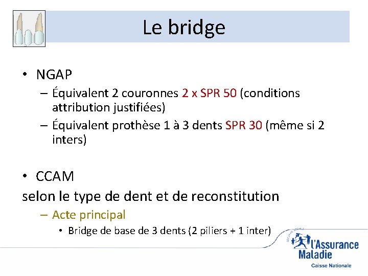 Le bridge • NGAP – Équivalent 2 couronnes 2 x SPR 50 (conditions attribution